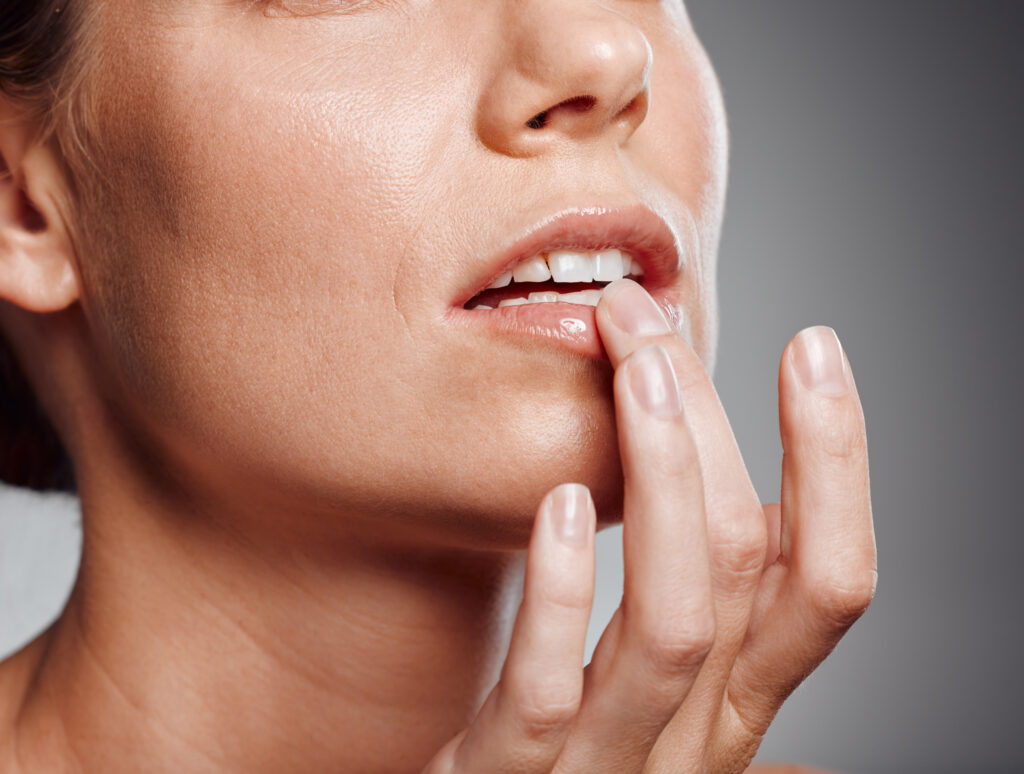 healing for cold sores