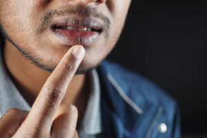 close up of a young men hand dry lips